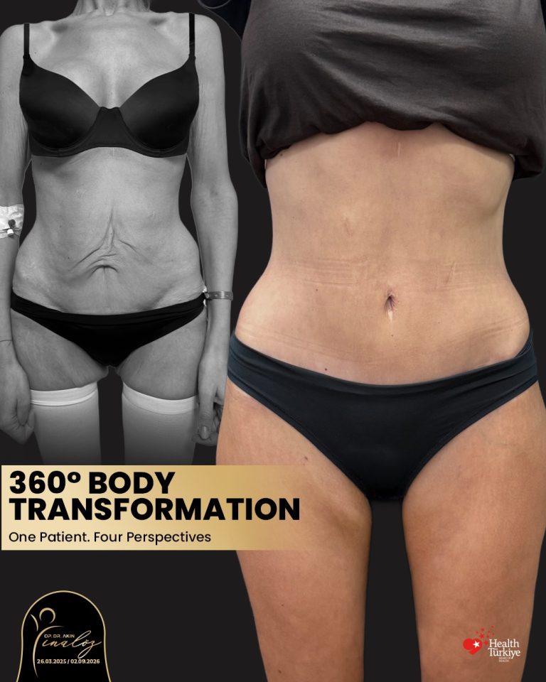 body1