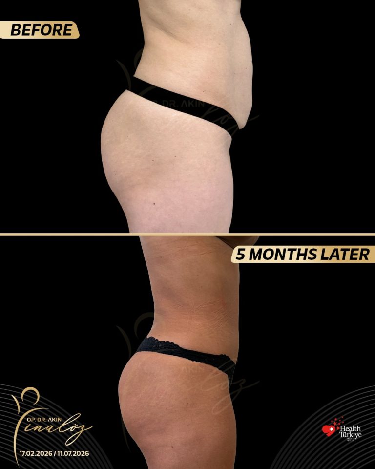 body3
