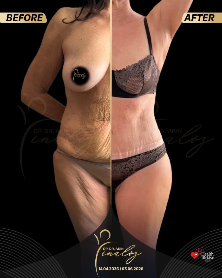 body4