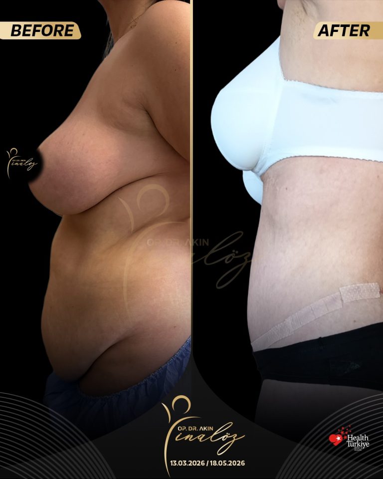 body5