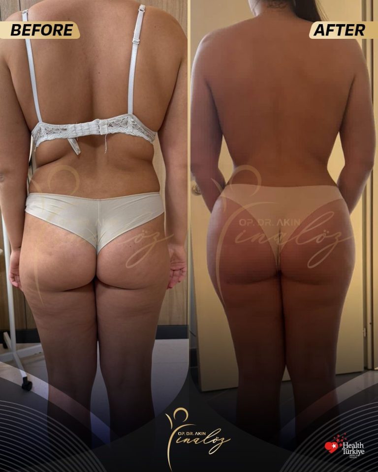 body6